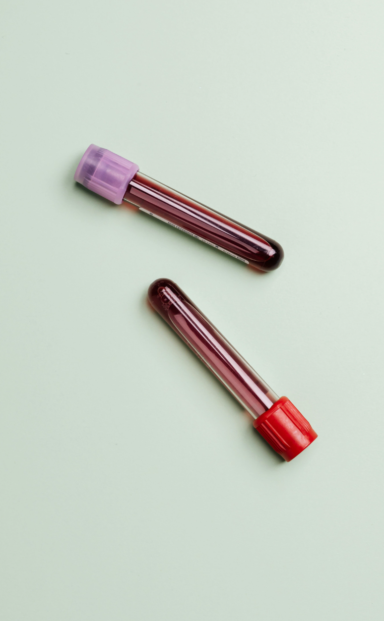 PRP-injection-therapy